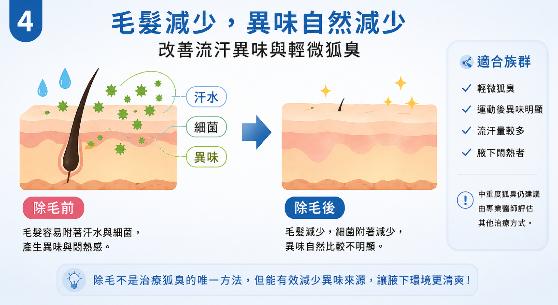 腋下除毛減少細菌附著,改善流汗異味與輕微狐臭原理 腋下除毛減少細菌附著,改善流汗異味與輕微狐臭原理