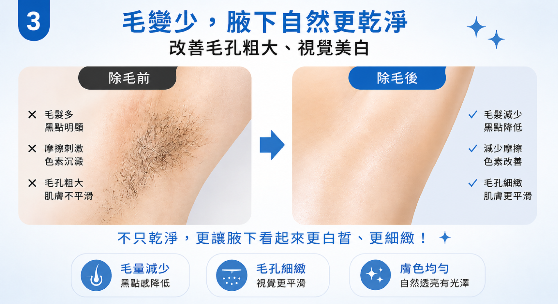 腋下雷射除毛前後比較,改善毛孔粗大與暗沉效果 腋下雷射除毛前後比較,改善毛孔粗大與暗沉效果