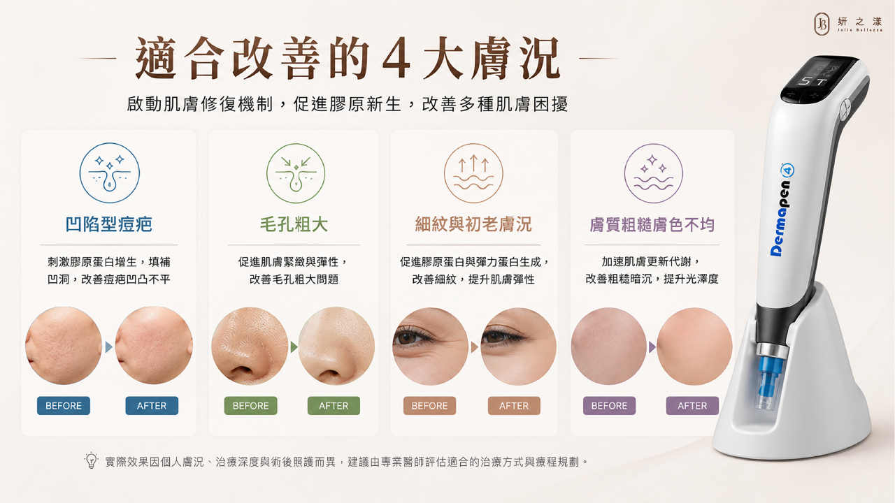 Dermapen 適合改善的4大膚況 Dermapen 適合改善的4大膚況
