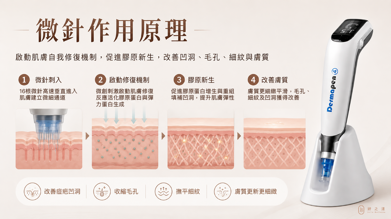 得美微針筆原理示意圖 得美微針筆原理示意圖