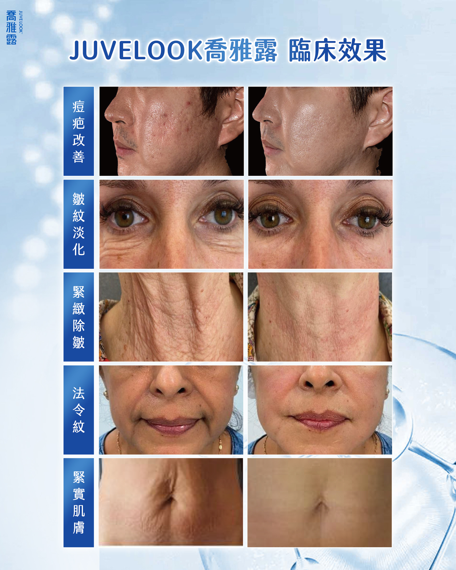 ALL_fac_26A12_slu4HRHAlu ALL_fac_26A12_slu4HRHAlu